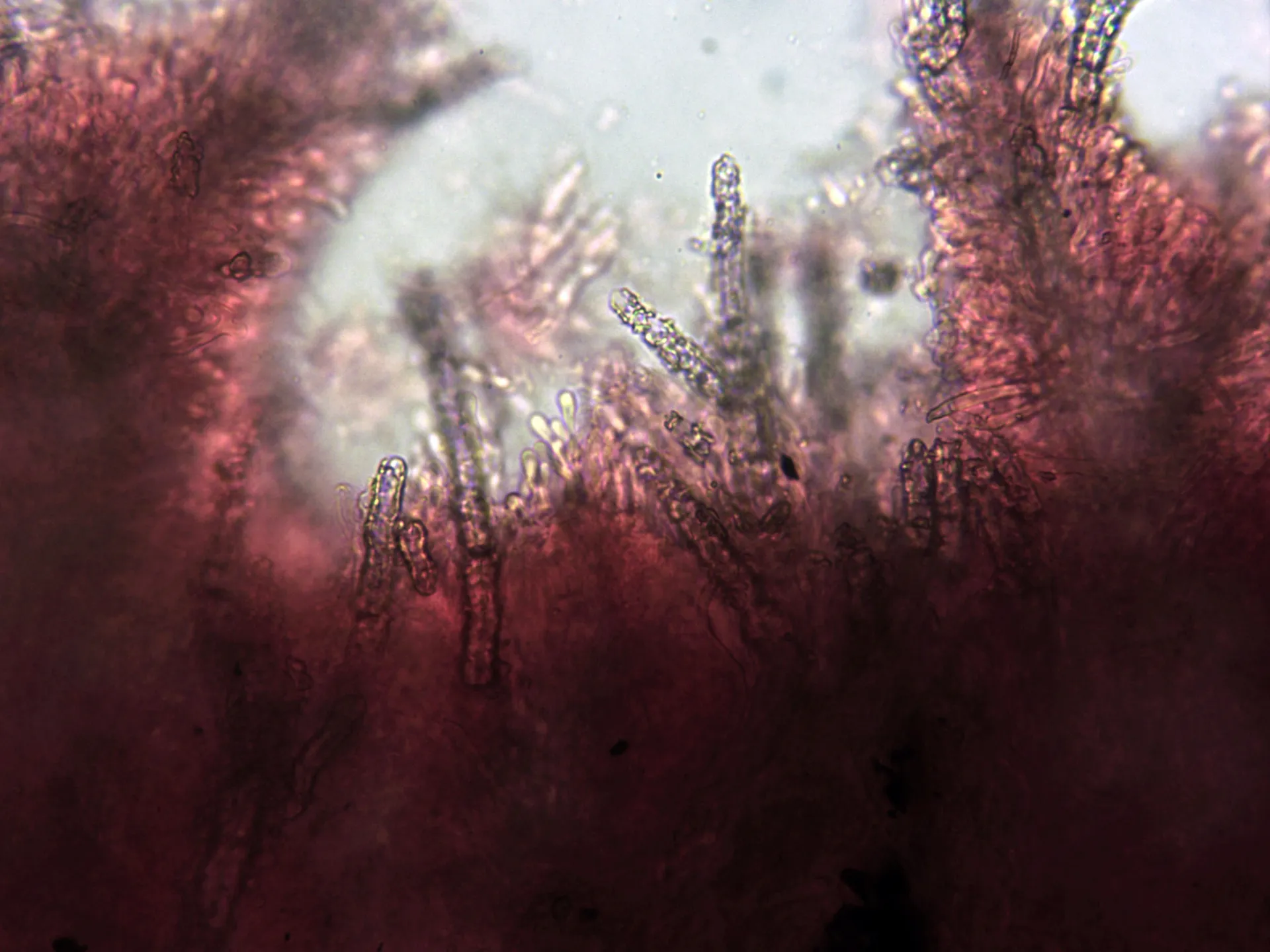 Microscopía de Steccherinum fimbriatum - 11 - Cistidios x 400 2